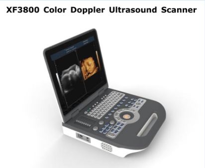Máy siêu âm 4D doppler màu XF3800